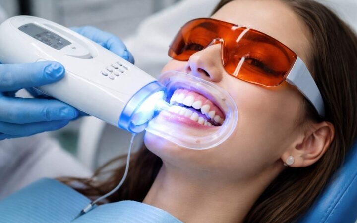 teeth whitening at home