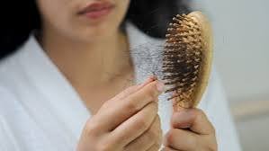 female hair loss Singapore